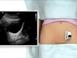 First trimester ultrasound