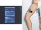 lower limb ultrasound