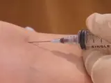 Venipuncture procedure on an arm