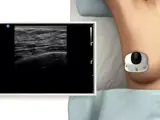ultrasound of the breast