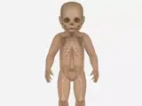 Pediatric Hip and Spine Ultrasound Assessment