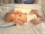 General Pediatric Ultrasound scans