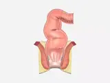 illustration of the rectal area 