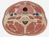 Thyroid and Parathyroid Ultrasound Assessment