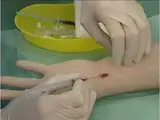 arterial line insertion 