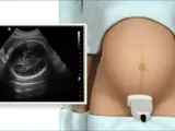 ultrasound to check on fetal growth